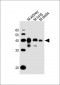 (Mouse) Epcam Antibody (C-term)