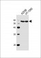 MMP14 Antibody (C-term)