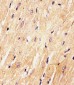 (Mouse) Med15 Antibody (C-term)