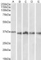 Goat Anti-Aurora Kinase B Antibody