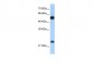 RPL13 antibody - C-terminal region