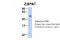 ZGPAT antibody - C-terminal region