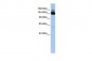 SYMPK antibody - middle region