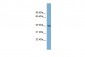 TRIM63 antibody - middle region