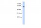 TRIM55 antibody - N-terminal region