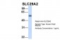 SLC29A2 antibody - C-terminal region