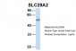 SLC29A2 antibody - C-terminal region