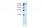 SLC5A4 antibody - N-terminal region