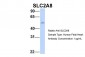 SLC2A8 antibody - middle region