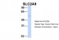 SLC2A8 antibody - middle region