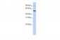 SLC36A2 antibody - N-terminal region