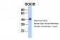 SGCB antibody - middle region