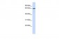 GPR177 antibody - middle region