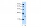 PDPN antibody - N-terminal region