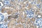 SDCBP antibody - middle region