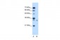 SDCBP antibody - middle region