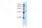 LRRC26 antibody - middle region