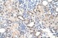 RORA antibody - middle region