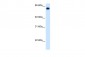 ALDH4A1 antibody - C-terminal region