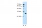SBDS antibody - C-terminal region
