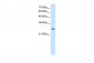 AK2 antibody - N-terminal region