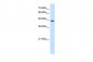 CTH antibody - C-terminal region