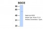 SGCE antibody - N-terminal region