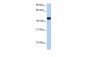 RTN4 antibody - middle region