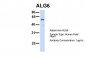 ALG6 antibody - N-terminal region