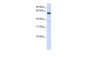 ALG6 antibody - N-terminal region