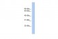 ST6GALNAC6 antibody - N-terminal region