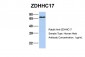 ZDHHC17 antibody - middle region