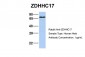 ZDHHC17 antibody - middle region