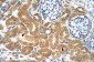 TMEM69 antibody - middle region