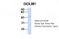 GOLM1 antibody - N-terminal region