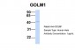 GOLM1 antibody - N-terminal region