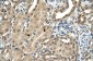 TBX15 antibody - C-terminal region