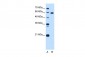 TBX15 antibody - C-terminal region