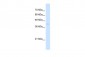 ARRB2 antibody - middle region