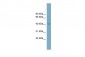 SLC30A8 antibody - middle region