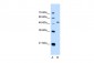 PAX8 antibody - N-terminal region