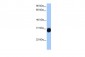 IGFBP7 antibody - C-terminal region