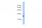 NMNAT1 antibody - N-terminal region