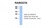 RABGGTA antibody - N-terminal region