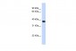 ACBD4 antibody - N-terminal region