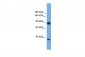 DLG4 antibody - middle region