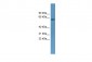 TOM1 antibody - middle region