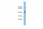 ACTR1B antibody - middle region