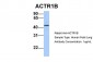 ACTR1B antibody - C-terminal region