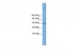 TACC3 antibody - middle region